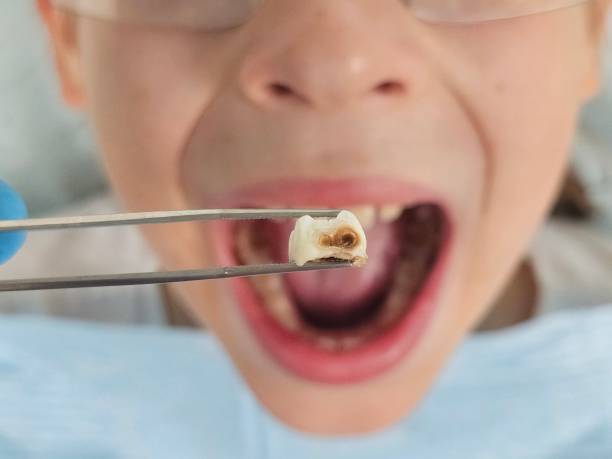 Best Emergency Denture Repair in Kilmarnock, VA