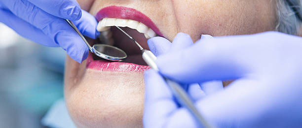 Best Dental Abscess Treatment in Kilmarnock, VA